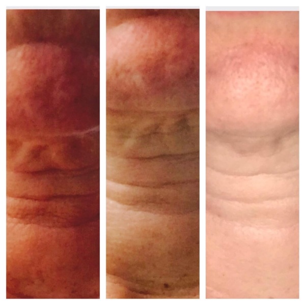 Before and after results using YEOUTH Neck Firming Cream — visible improvement in neck firmness and smoothness